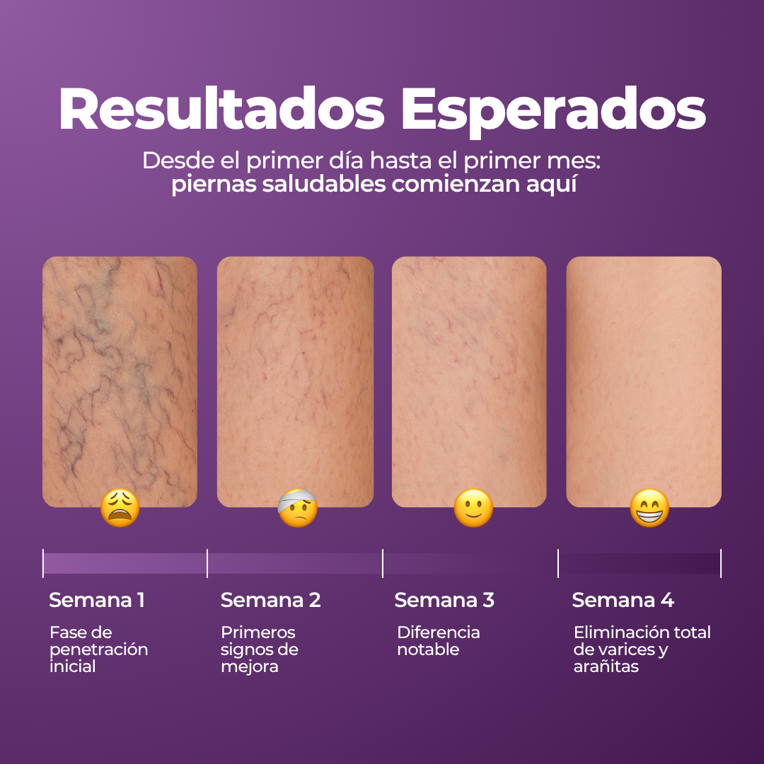 VARISENS - LOCIÓN DE PIERNAS - AUREVA