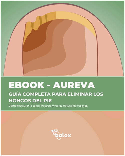 EBOOK - GUÍA COMPLETA PARA ELIMINAR LOS HONGOS DE LAS UÑAS - TIPS Y PASOS PARA ELIMINAR LOS HONGOS PARA SIEMPRE DE FORMA NATURAL