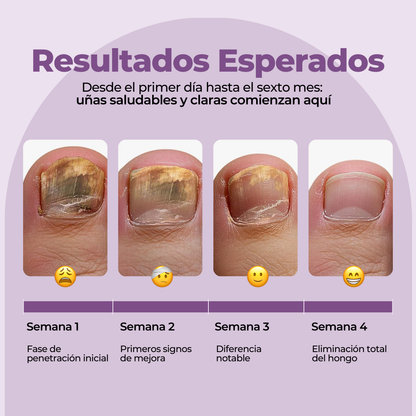 FUNGUVEX: El aceite que elimina el 99.9% de los hongos en tus uñas.