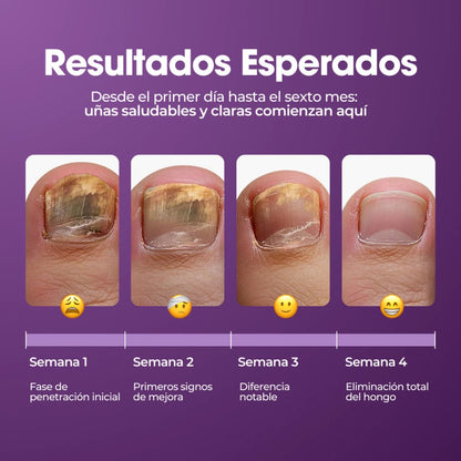 FUNGIVEX: El aceite que elimina el 99.9% de los hongos en tus uñas.